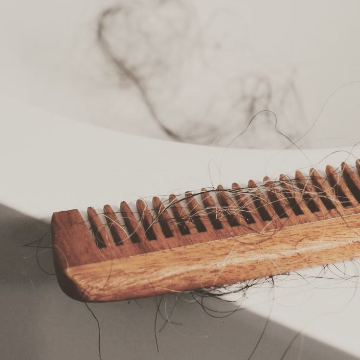 ¿Están relacionados el acné y la alopecia?