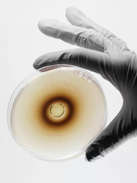 4. Estudio de Microecología y Microbiota en Heces